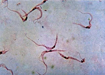 Trypanosoma cruzi chagas