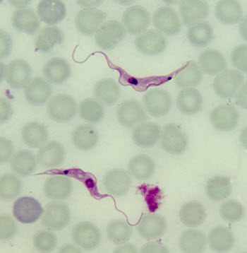Trypanosoma cruzi